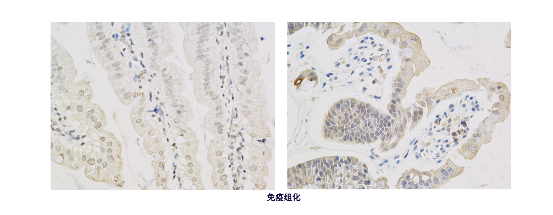 免疫组化 (2).png