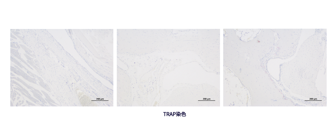 TRAP染色 (2).png