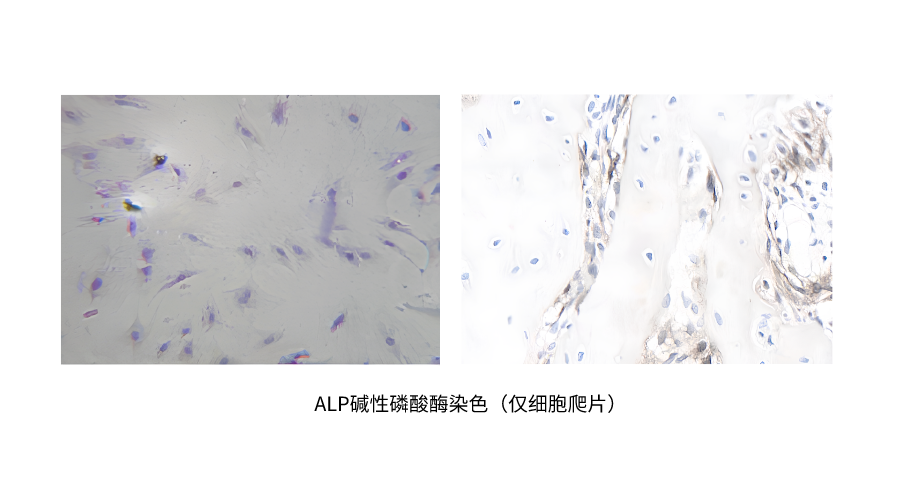 ALP碱性磷酸酶染色（仅细胞爬片） (2).png