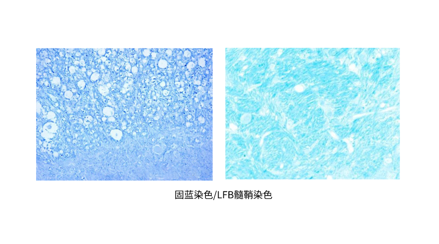 固蓝染色LFB髓鞘染色.png