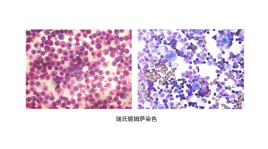 瑞氏姬姆萨染色 (2).png