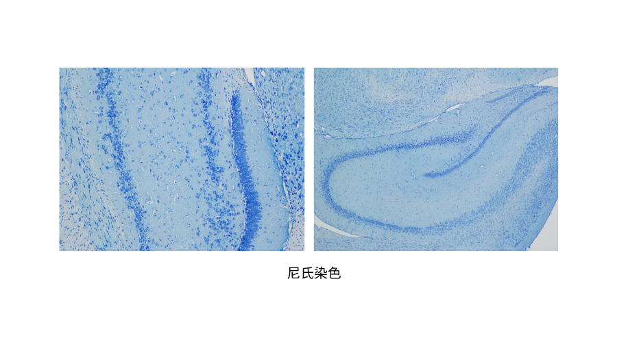 尼氏染色 (2).png