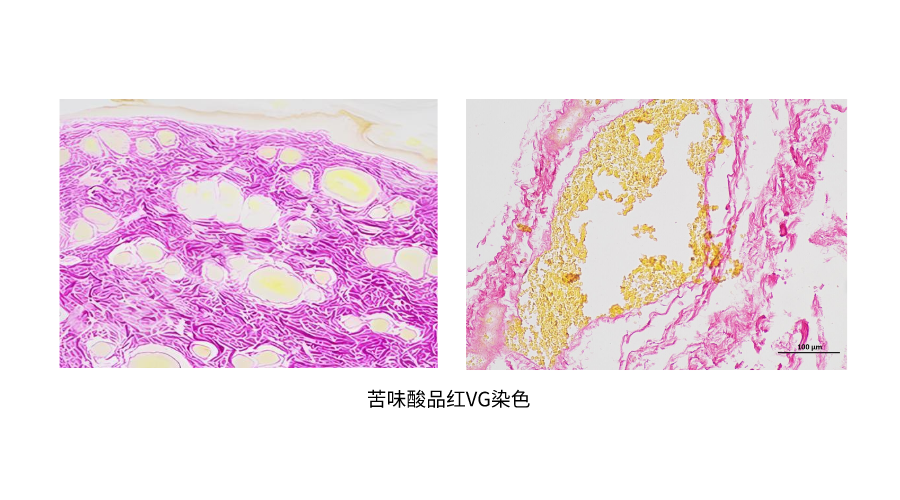 苦味酸品红VG染色 (2).png