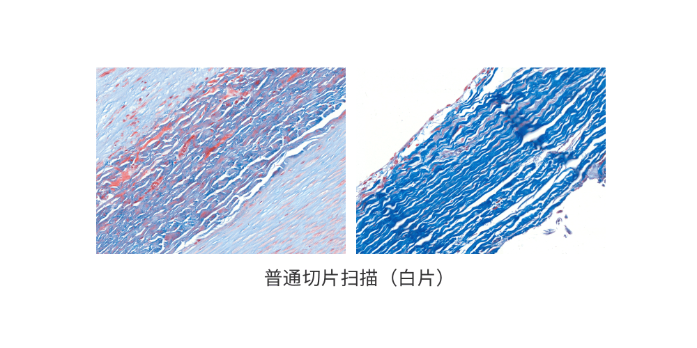 1690940832157086.png 普通切片扫描(白片) (2).png