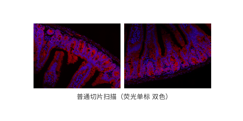 普通切片扫描（荧光单标 双色） (1).png