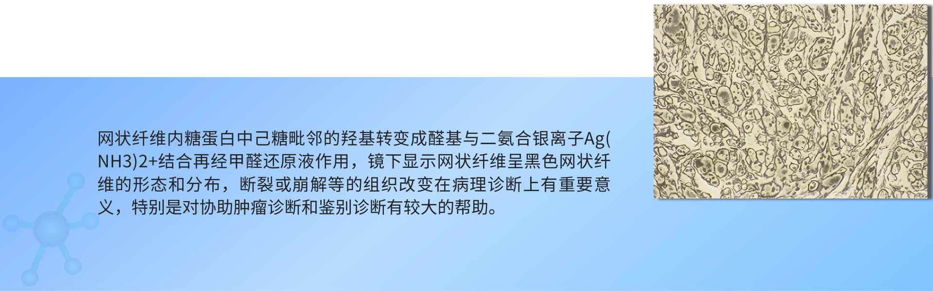 1691484918192994.png 网状纤维染色.png