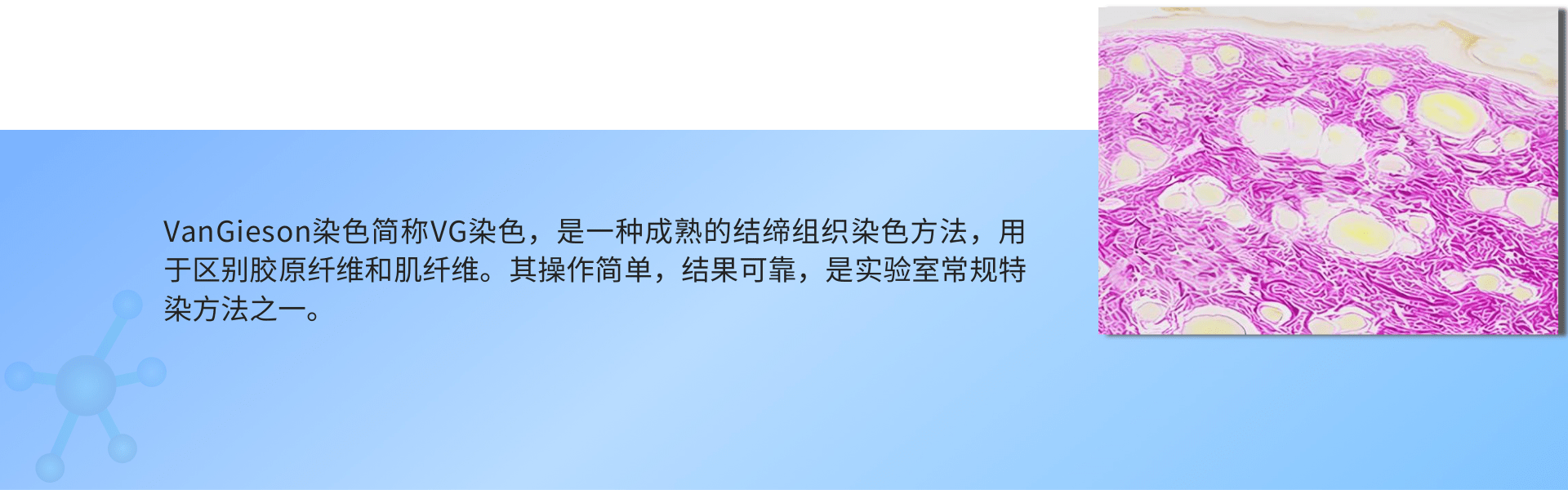 苦味酸品红VG染色 (1).png