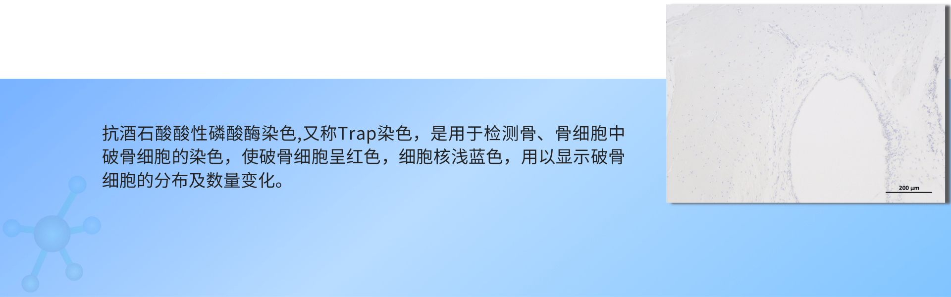 TRAP染色 (1).png