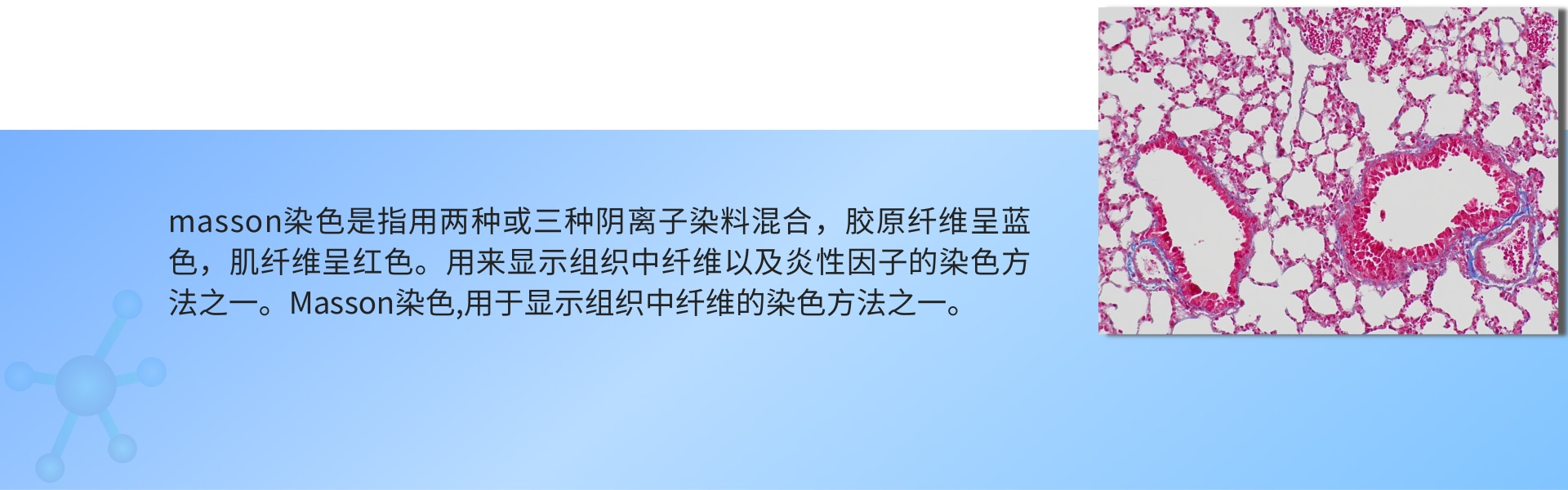 masson染色.jpg