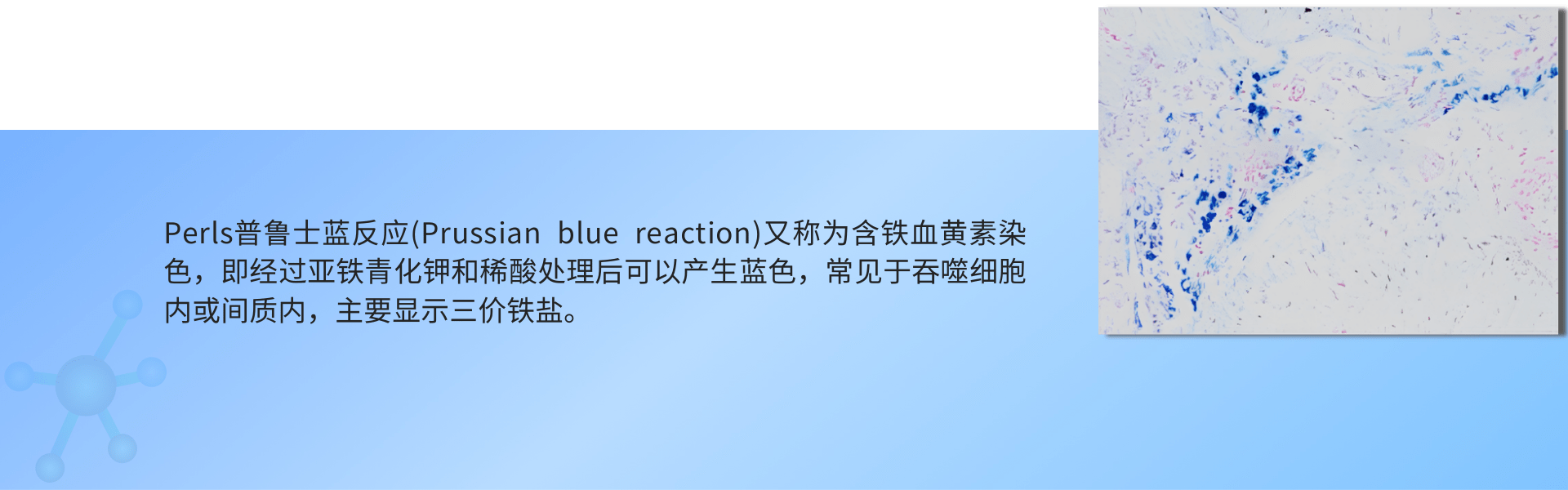 普鲁士蓝染色.png