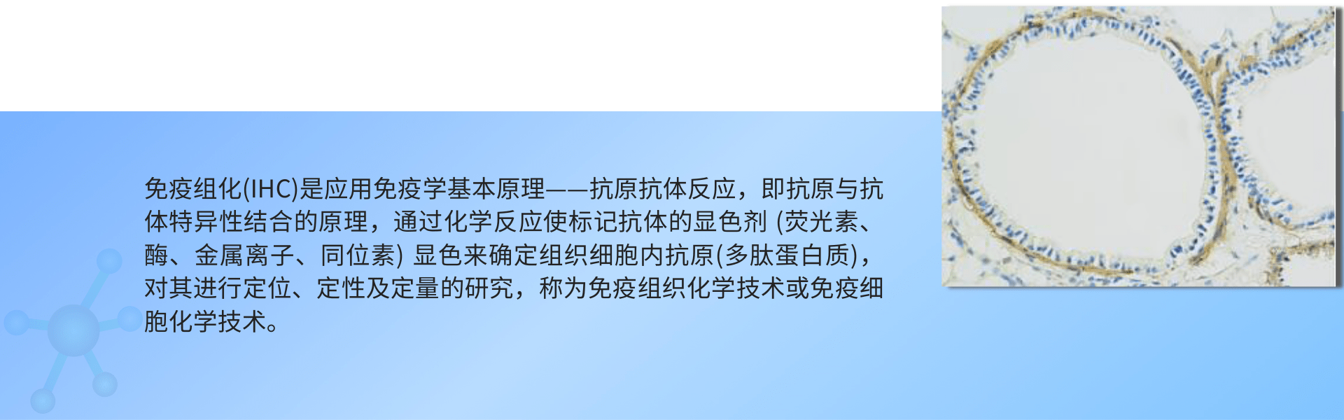 免疫组化.png