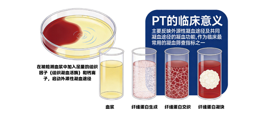 凝血四项之凝血酶原时间(PT)